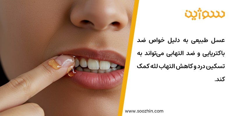 عسل برای درمان عفونت گلو، لوزه و مجاری تنفسی فوقانی